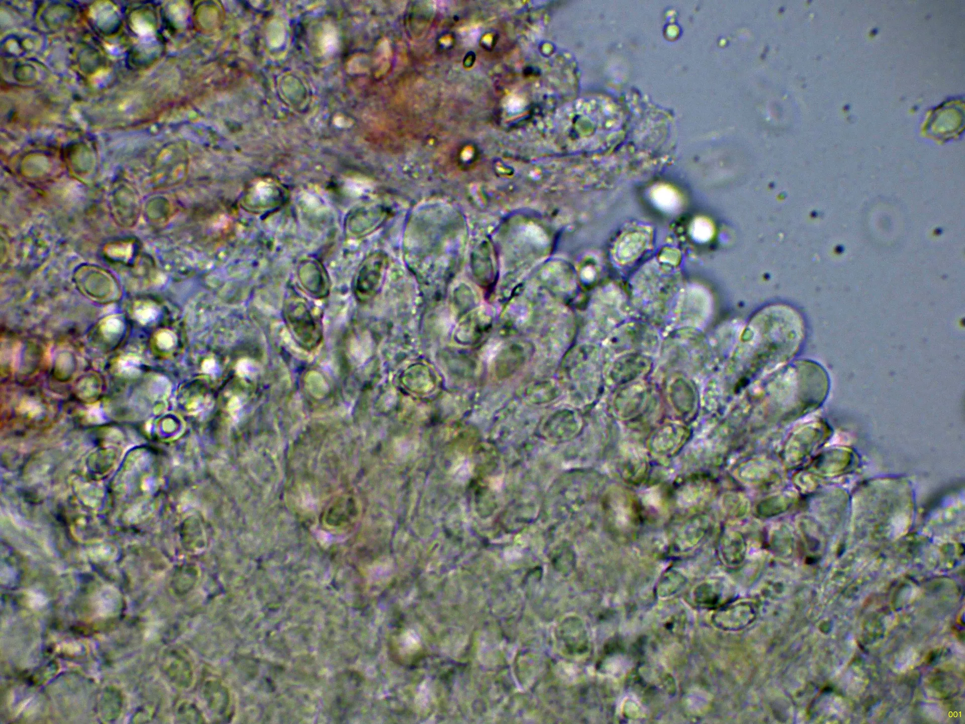 Microscopía de Trechispora fastidiosa - 10 - Basidios KOH-001